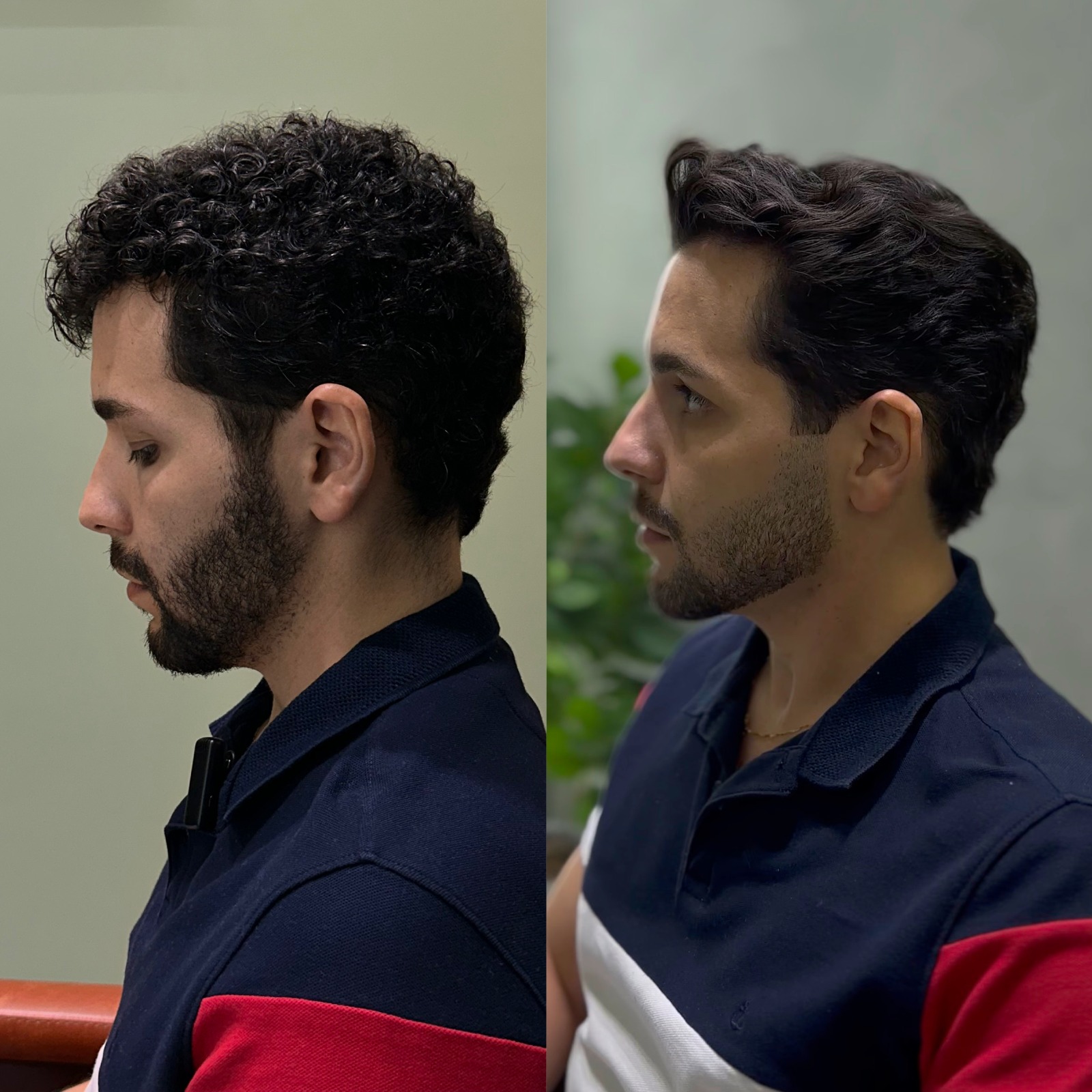 Antes e depois de barba e cabelo com visagismo no Image Visage em Ribeirão Preto